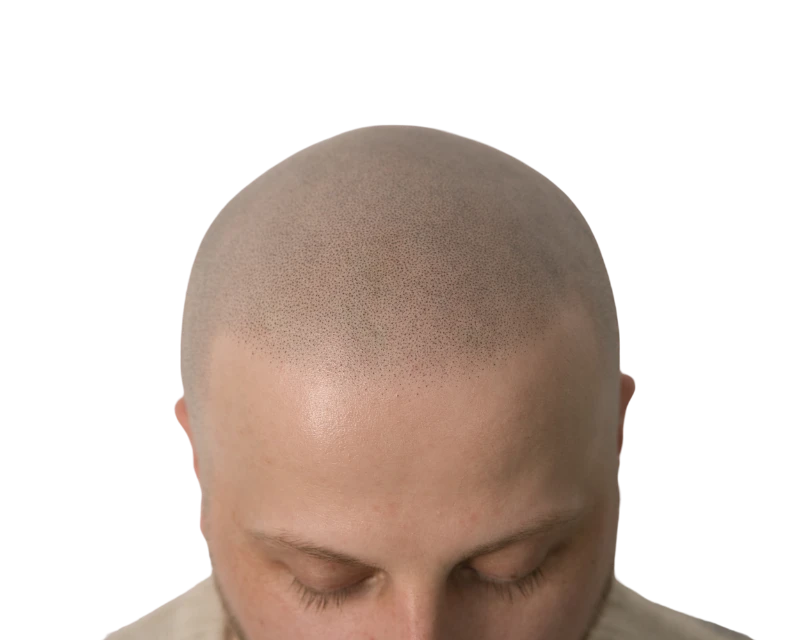 Shaved Look Naturalle I Scalp Frankfurt